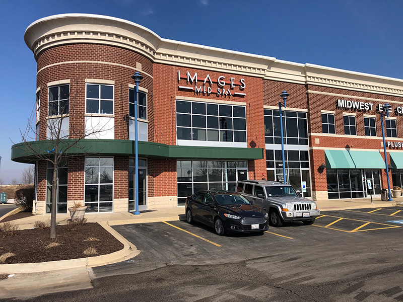 R.D. Masonry Mokena, IL Commercial Building Project
